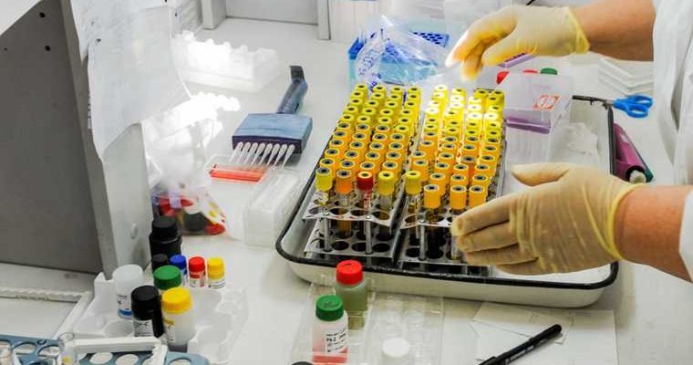 В Салехарде забыли о дезинфекции теплых остановок — медиков обвинили в недостатке лекарств — две лаборатории перейдут на круглосуточный режим работы — в Новом Уренгое и Ноябрьске назначены чиновники. Все самые интересные и важные новости ЯНАО к утру 11 ноября — в обзоре URA.RU: