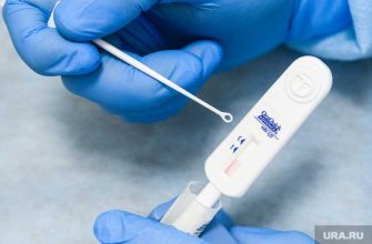 ВИЧ инфекция